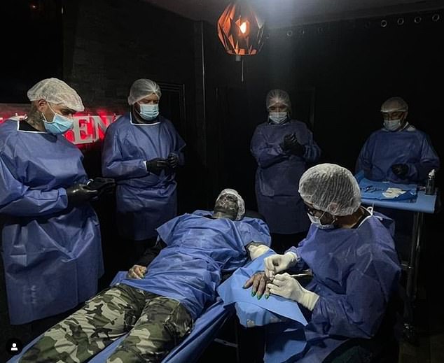 Mr Loffreddo is pictured above during the procedure to have his fingers removed. It was not carried out by doctors in a medical facility.