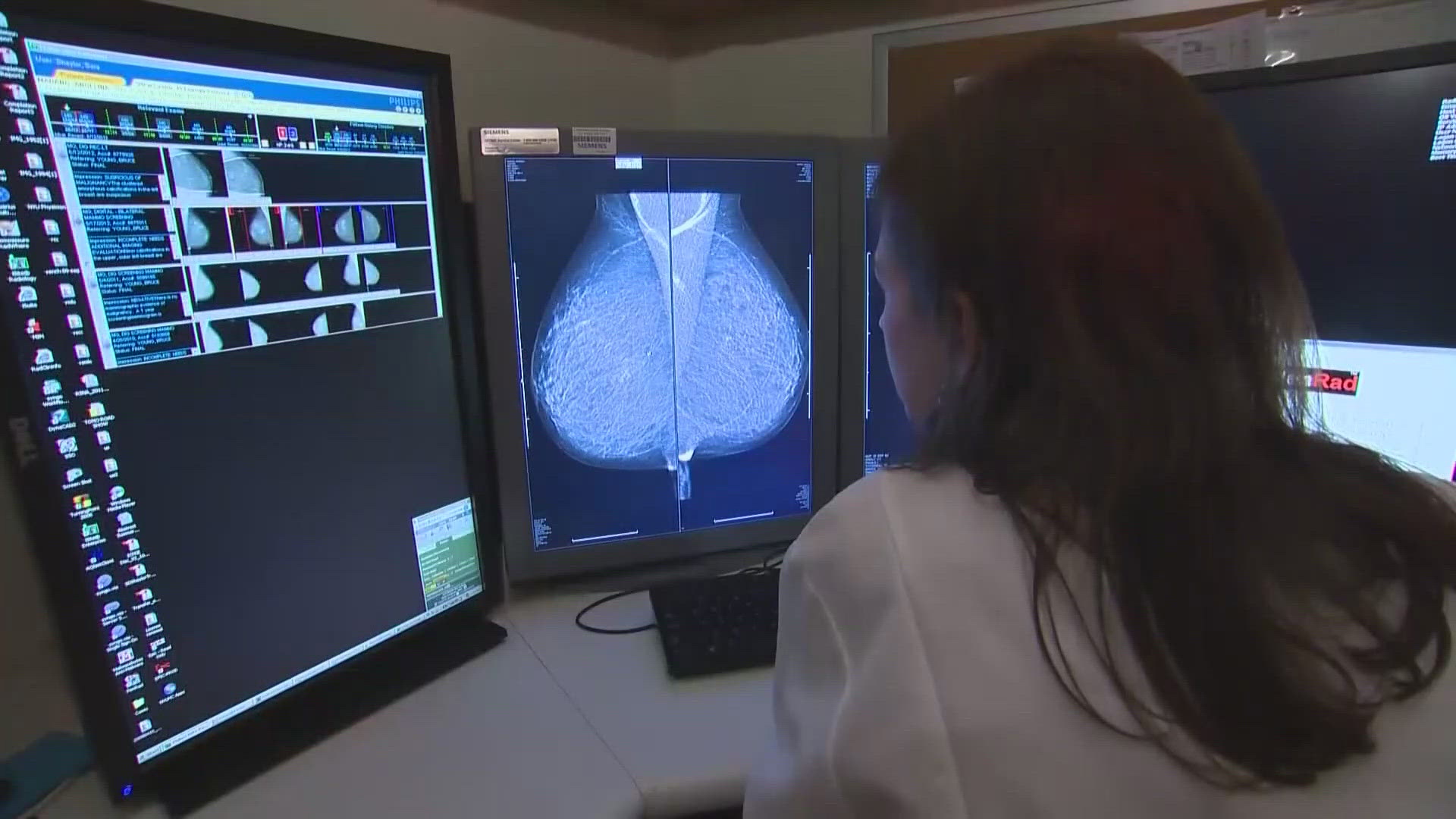 A new study shows that Black women are at a higher risk of dying from breast cancer and researchers say racial disparities could be to blame.