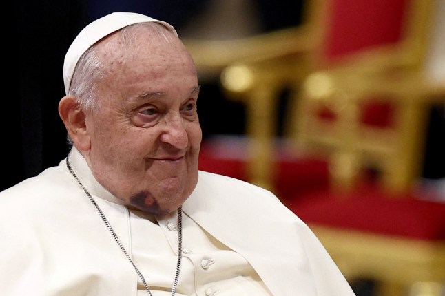 Bruise on Pope's cheek.