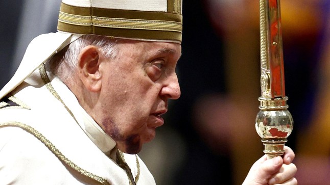 Pope Francis, with a large bruise on his chin, leaves after attending a consistory ceremony to elevate Roman Catholic prelates to the rank of cardinal, in Saint Peter's Basilica at the Vatican, December 7, 2024. REUTERS/Guglielmo Mangiapane