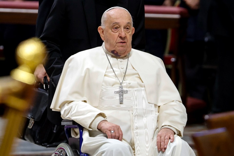 Pope Francis now uses a wheelchair due to back and knee pains